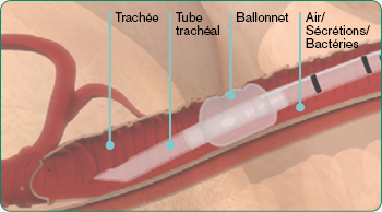 explore-image-oral-care-vap-facts-3-FR.png